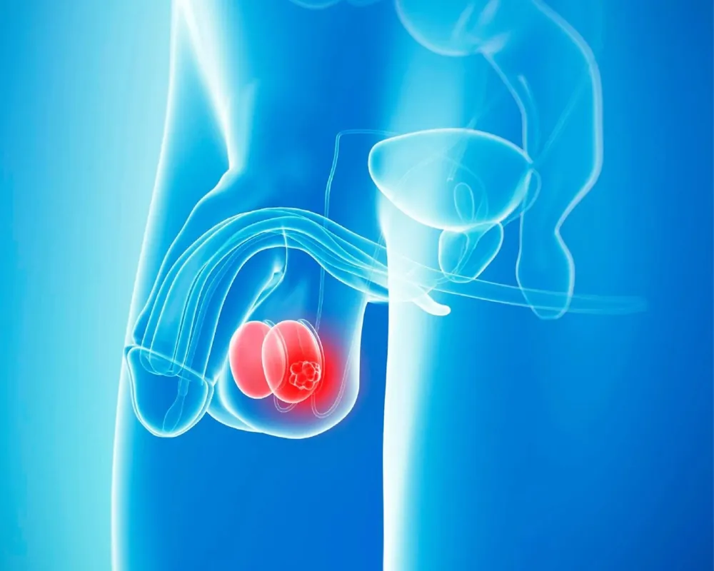 Prostat bezinin yerini gösteren anatomik illüstrasyon