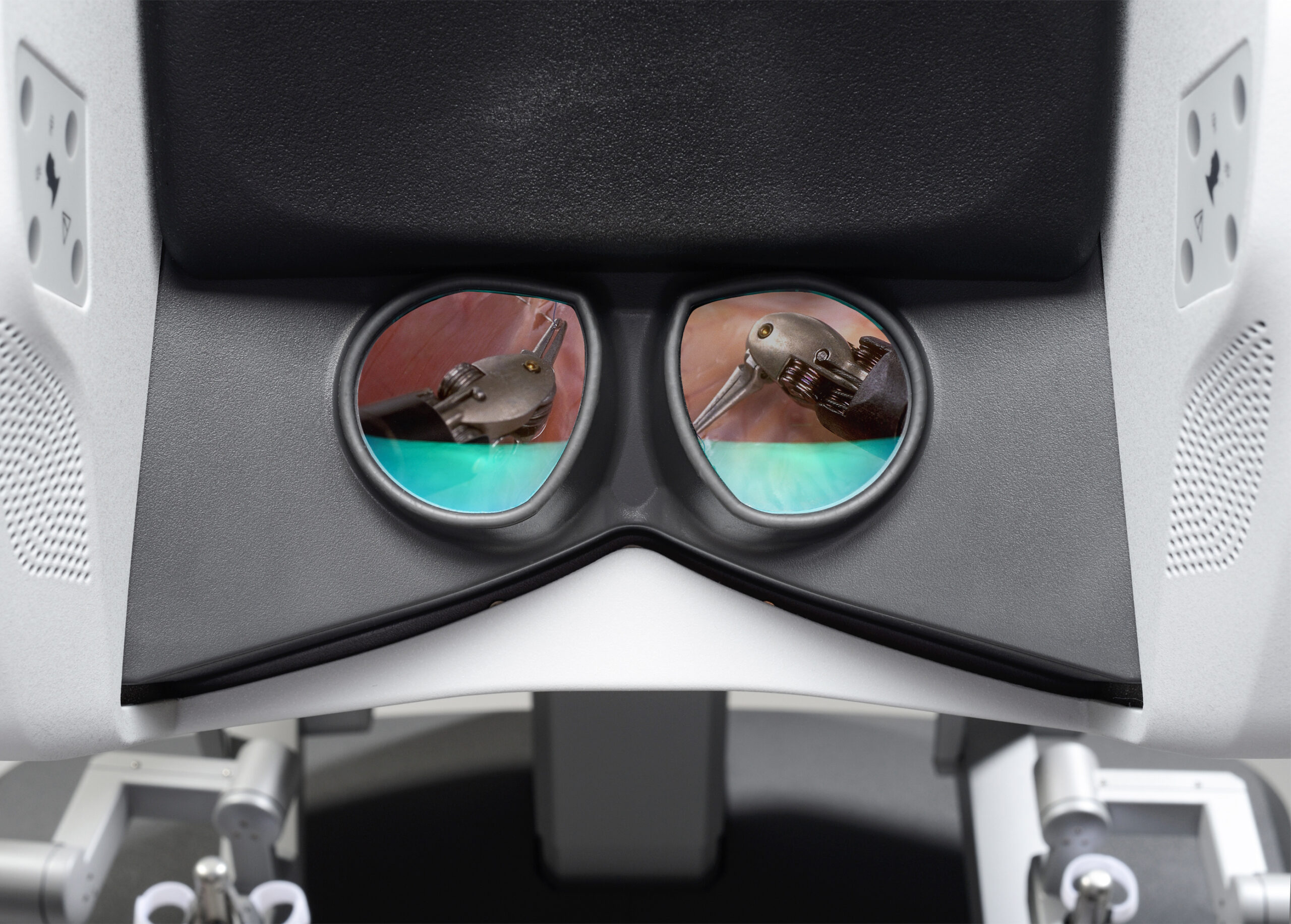 Cihaz-Göz https://www.bursarobotikcerrahi.com/wp-content/uploads/2025/10/Cihaz-Goz-scaled.jpg