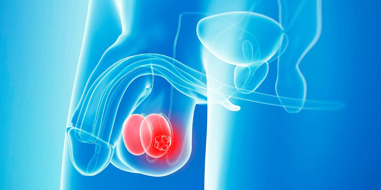 Prostat Kanserinde Hassas ve Güvenli Cerrahi Da Vinci Robotik Cerrahi