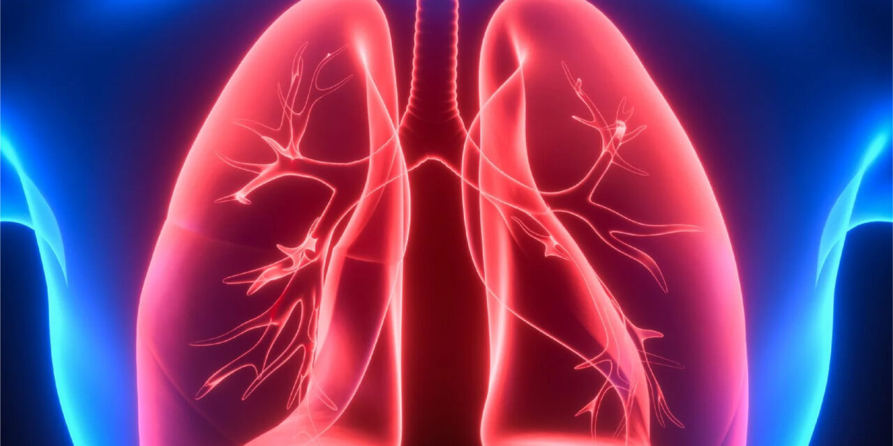 Akciğer Cerrahisinde İyileşme Sürecini Hızlandıran Teknoloji Da Vinci Robotik Cerrahi